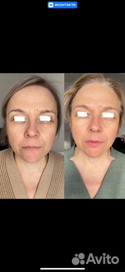 Массаж лица и тела