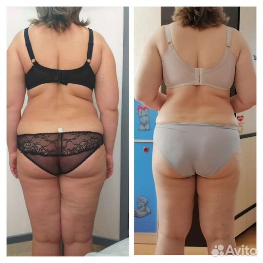 Lpg массаж тела