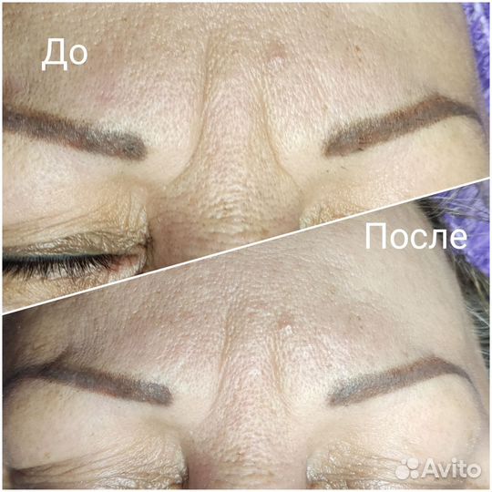 Услуги косметолога