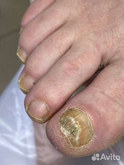 Услуги подолога