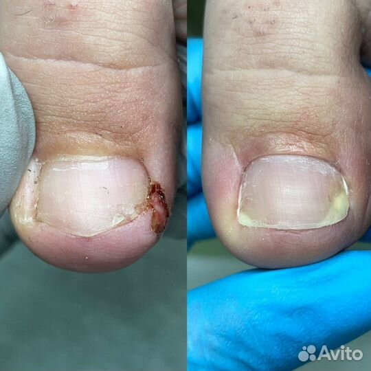 Услуги подолога