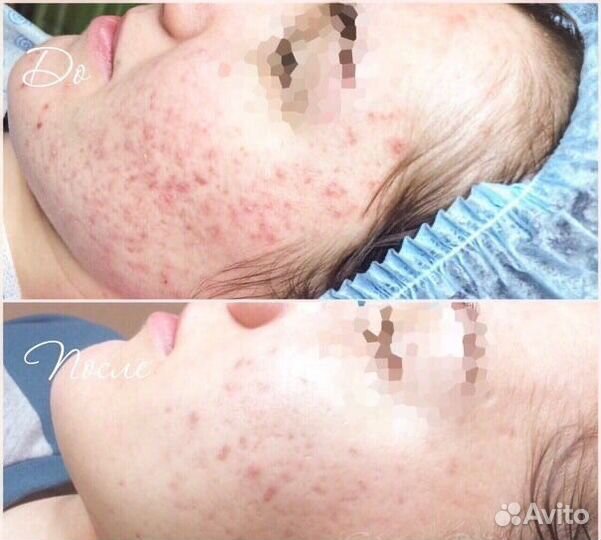 Услуги косметолога