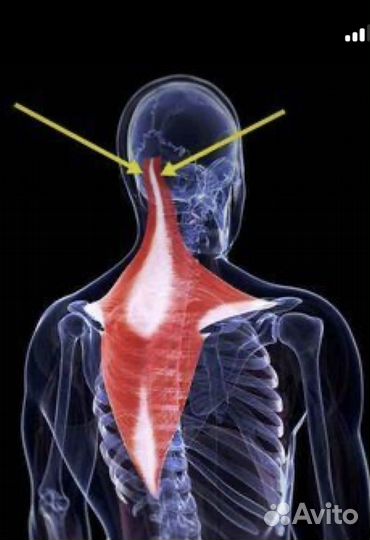 Иглоукалывание, Остеопат - Кинезиолог, гомеопат