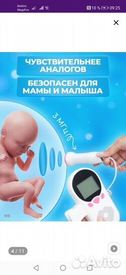 Доплер для беременных