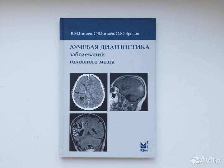 Лучевая диагностика заболеваний головного мозга