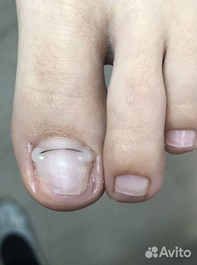 Педикюр подолог