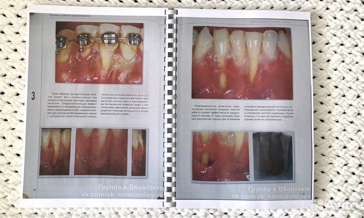 Пластическая хирургия мягких тканей полости рта