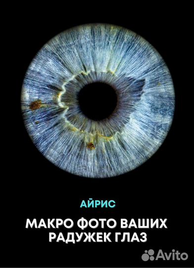 Фото радужки глаза
