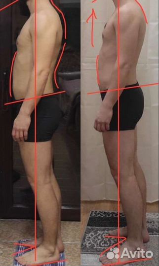 Массаж - реабилитация (оздоровление)