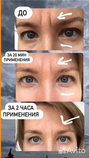 Гидрогеливые патчи натуральный состав