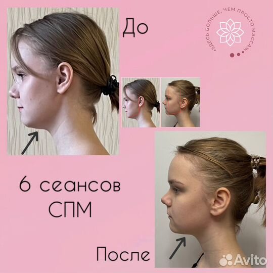 Массаж лица, моделирование тела