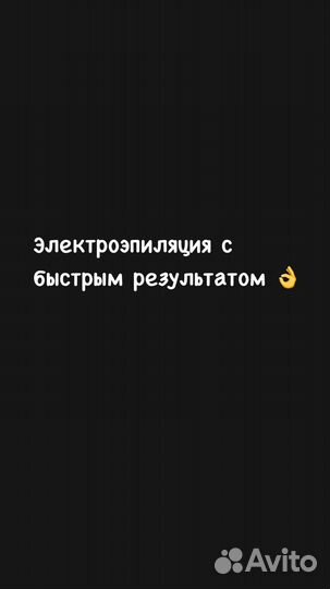 Электроэпиляция