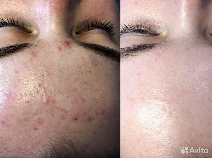 Косметика phformula