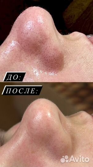 Услуги косметолога