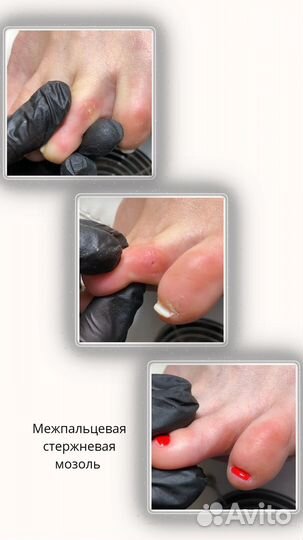 Подолог Мария Мусихина