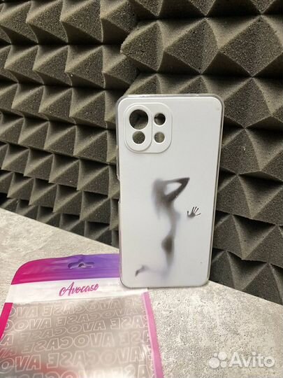 Чехол на Xiaomi Mi 11 Lite 5G NE