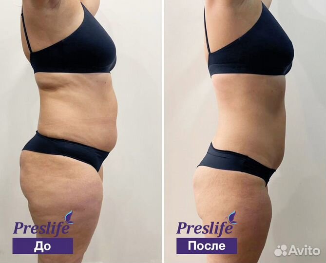 Прощай живот. Комплекс коррекции фигуры