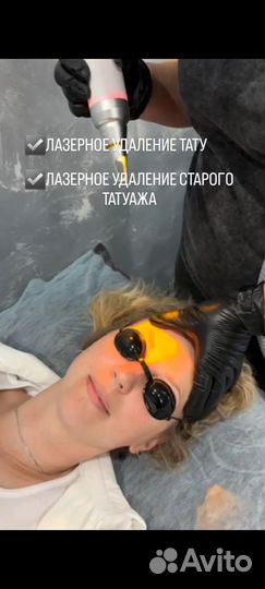 Лазерное удаление перманента татуажа