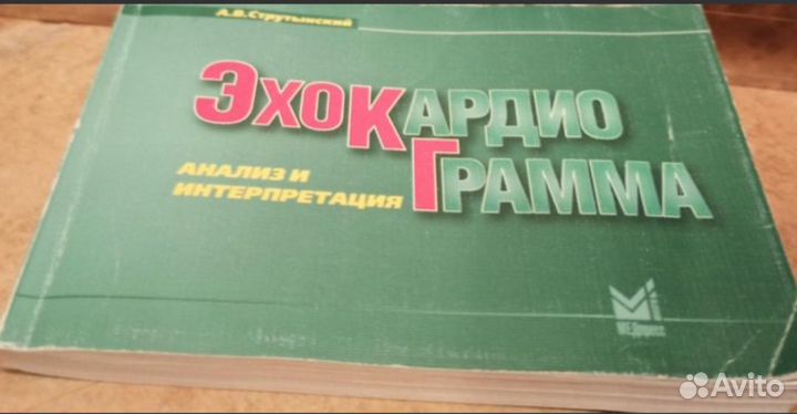 Карманный справочник эхокардиограмма
