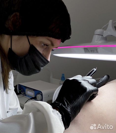 Электроэпиляция: подмышки