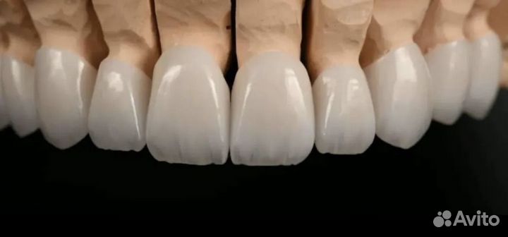 Услуги зубного техника