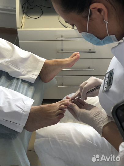 Вросший ноготь