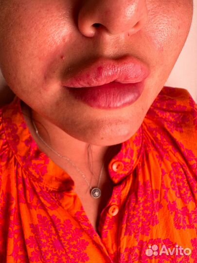 Обучение косметологии