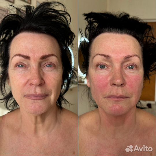 Массаж лица и тела