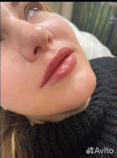 Увеличение губ