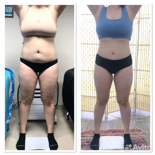 Аппаратная коррекция фигуры