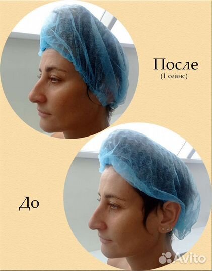 Массаж м.Алексеевская