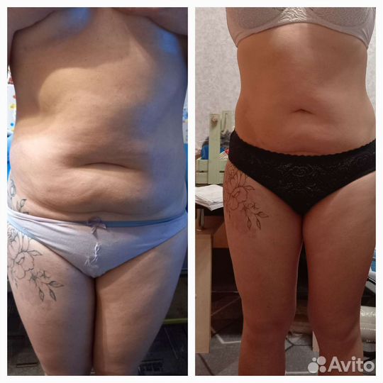 Массаж на дому