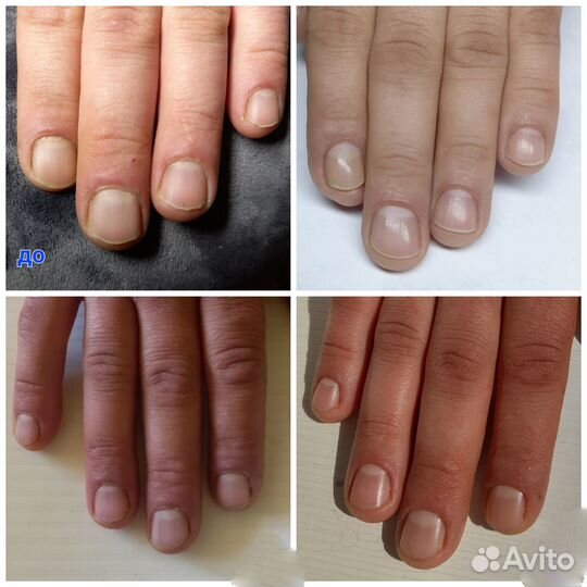 Маникюр на дому