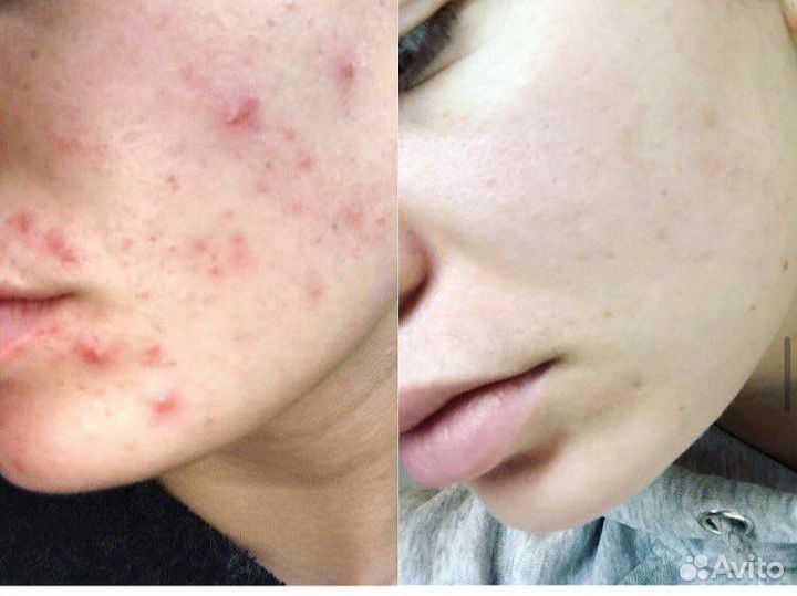 Косметика phformula