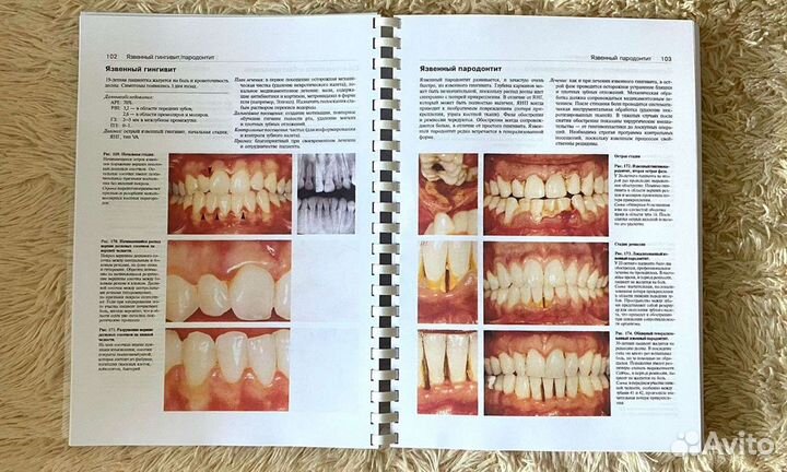 Пародонтология