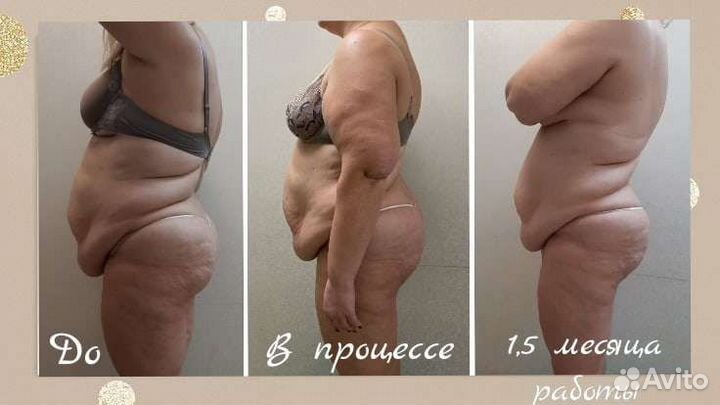 Коррекция фигуры