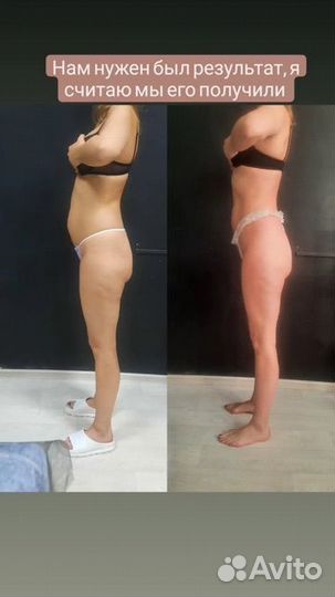 Вакуумный массаж кавитация rf