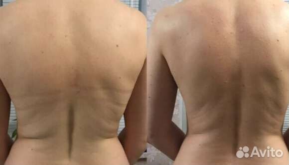 Массаж Лечебный Профи. Выезд на дом или кабинет