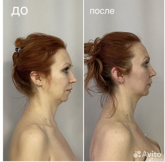 Массаж / остеопат / костоправ