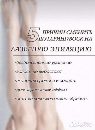 Лазерная эпиляция