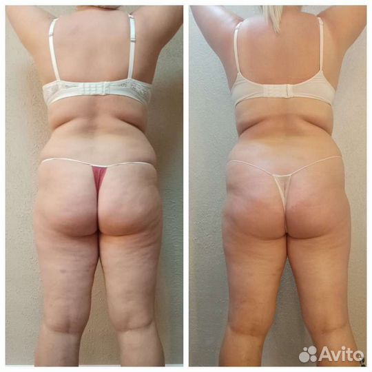 Массаж на дому