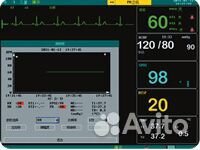 Монитор пациента Kernel KN-601M экран LCD 12,1