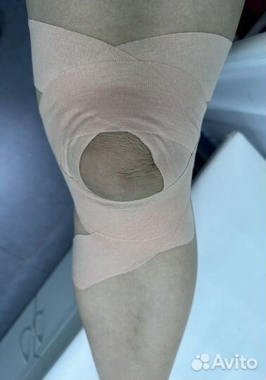 Тейпирование тела