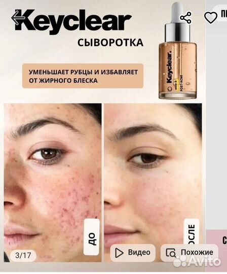 Крем/Сыворотка для лица Keyclear от постакне