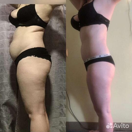 Антицеллюлитный массаж кавитация аппаратный