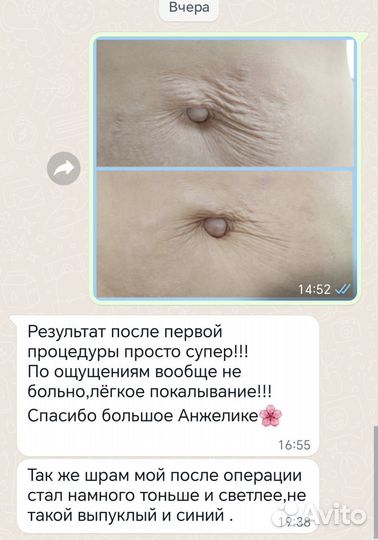 Холодная плазма