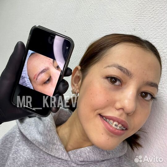 Удаление татуажа, перманента бровей, век, губ