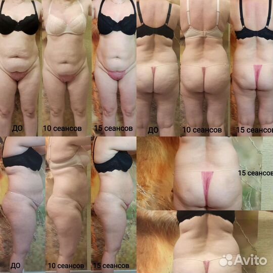 Депиляция, массаж, ламинирование