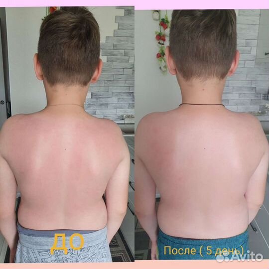 Детский массаж