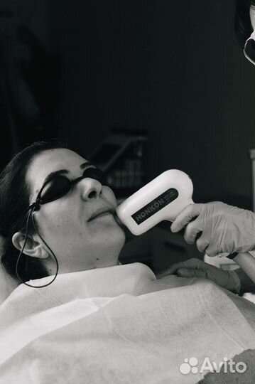 Лазерная эпиляция